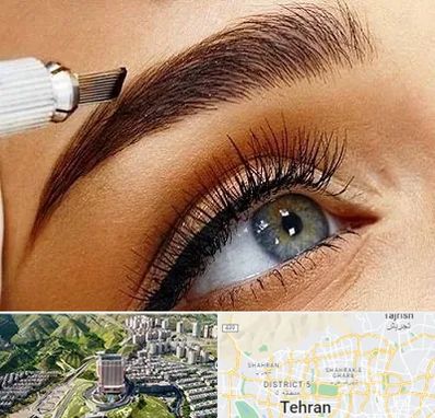 فیبروز ابرو در شمال تهران