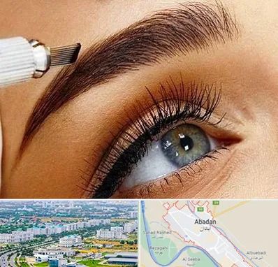 فیبروز ابرو در آبادان