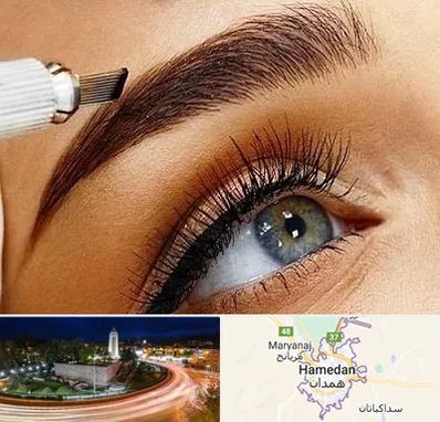 فیبروز ابرو در همدان