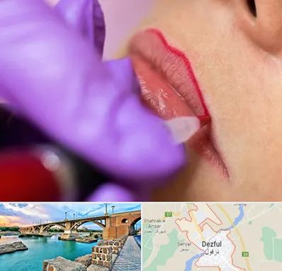 تاتو لب در دزفول