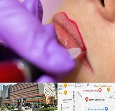 تاتو لب در سهروردی