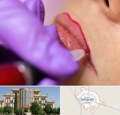 تاتو لب در دهدشت