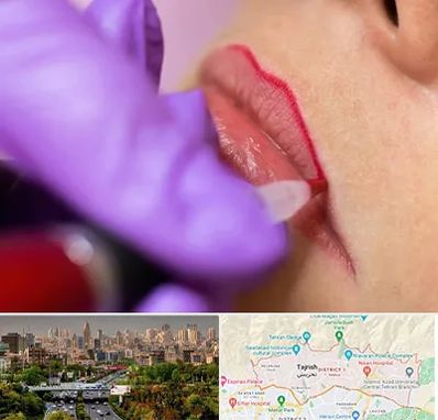 تاتو لب در منطقه 1 تهران