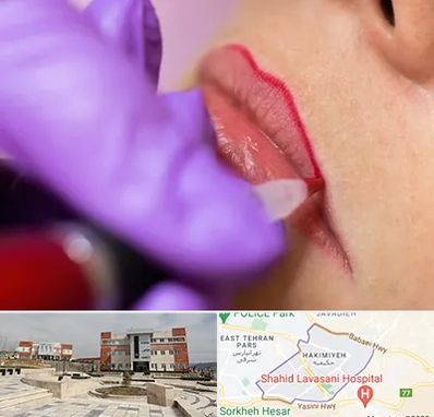 تاتو لب در حکیمیه