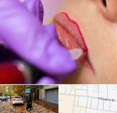 تاتو لب در خیابان فلسطین