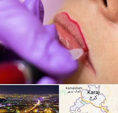 تاتو لب در کرج