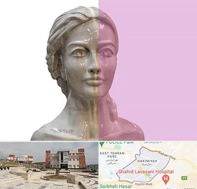 آموزشگاه قالب گیری در حکیمیه