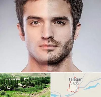 کاشت ریش و سبیل در طالقان