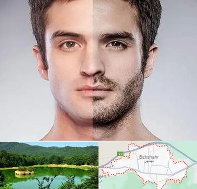 کاشت ریش و سبیل در بهشهر