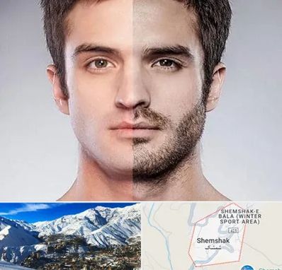 کاشت ریش و سبیل در شمشک