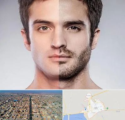 کاشت ریش و سبیل در بندر ماهشهر