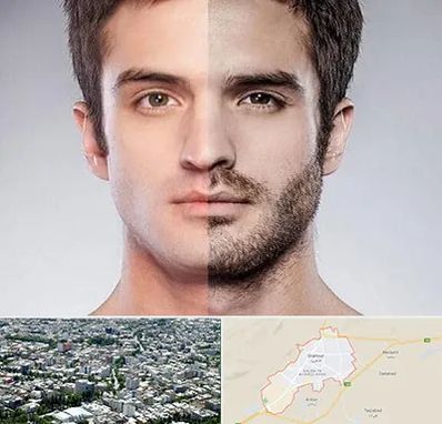 کاشت ریش و سبیل در شاهرود