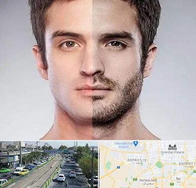 کاشت ریش و سبیل در جنوب تهران