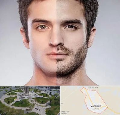 کاشت ریش و سبیل در ورامین