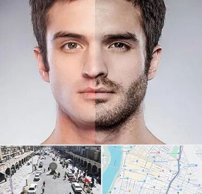 کاشت ریش و سبیل در نادری اهواز