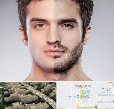 کاشت ریش و سبیل در اکباتان