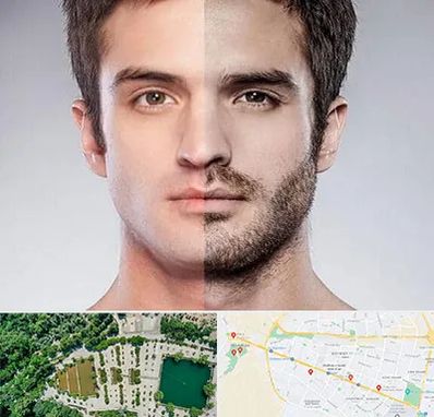 کاشت ریش و سبیل در وکیل آباد مشهد