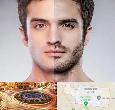 کاشت ریش و سبیل در بهارستان