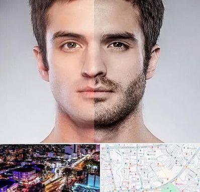 کاشت ریش و سبیل در منظریه رشت