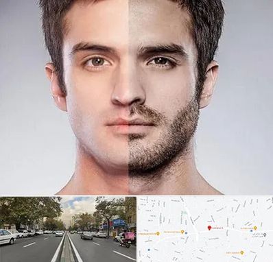 کاشت ریش و سبیل در دولت