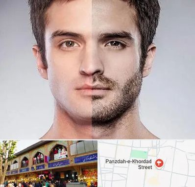 کاشت ریش و سبیل در 15 خرداد