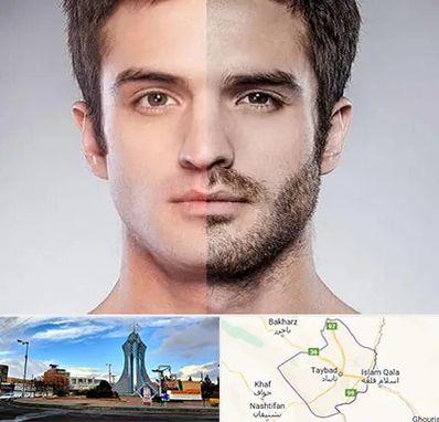 کاشت ریش و سبیل در تایباد