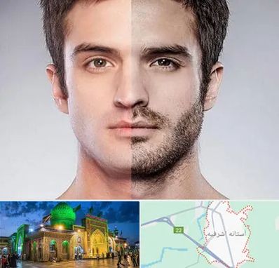 کاشت ریش و سبیل در آستانه اشرفیه