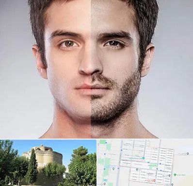 کاشت ریش و سبیل در مرداویج اصفهان