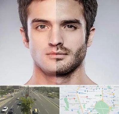 کاشت ریش و سبیل در منطقه 17 تهران