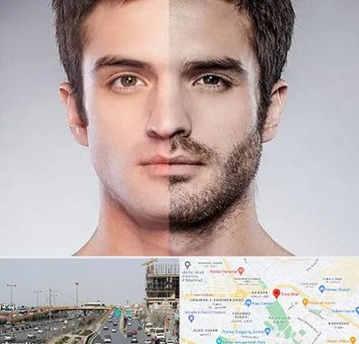 کاشت ریش و سبیل در بلوار توس مشهد