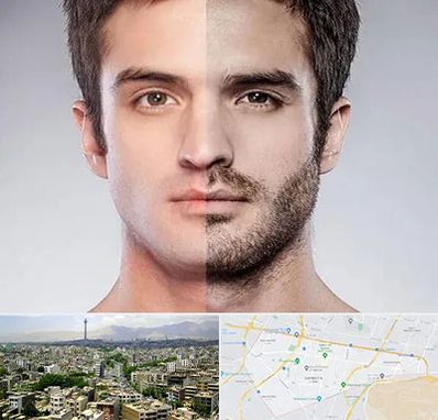 کاشت ریش و سبیل در منطقه 8 تهران