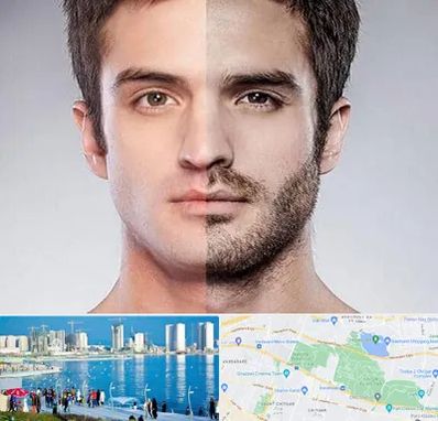 کاشت ریش و سبیل در چیتگر