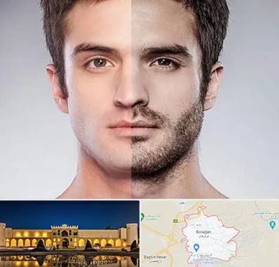 کاشت ریش و سبیل در برازجان