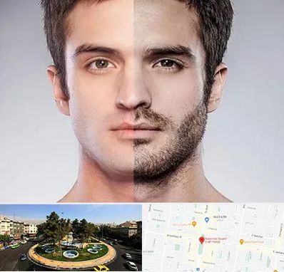 کاشت ریش و سبیل در هفت حوض