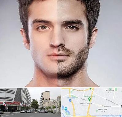 کاشت ریش و سبیل در بلوار فردوس