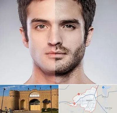 کاشت ریش و سبیل در ایرانشهر