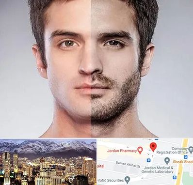 کاشت ریش و سبیل در جردن