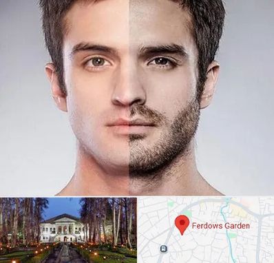 کاشت ریش و سبیل در باغ فردوس