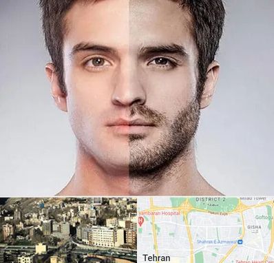 کاشت ریش و سبیل در مرزداران