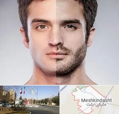 کاشت ریش و سبیل در مشکین دشت