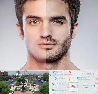 کاشت ریش و سبیل در بهارستان