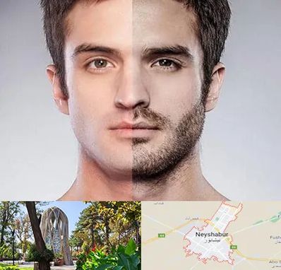 کاشت ریش و سبیل در نیشابور