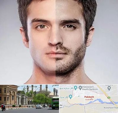 کاشت ریش و سبیل در پاکدشت