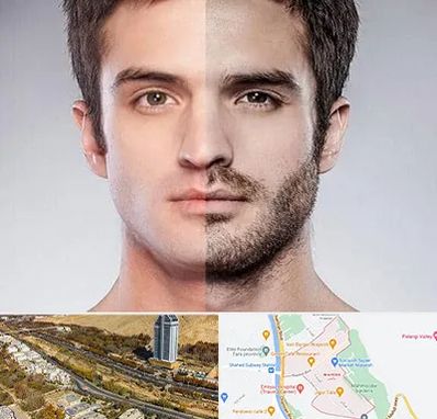 کاشت ریش و سبیل در خیابان نیایش شیراز