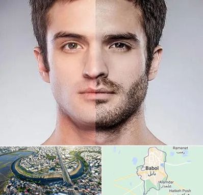 کاشت ریش و سبیل در بابل