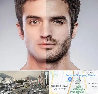 کاشت ریش و سبیل در پونک