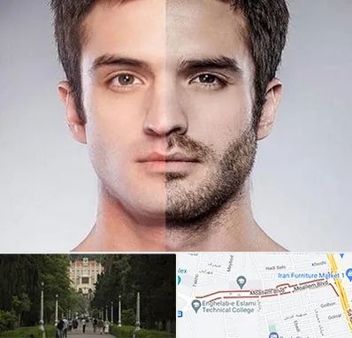 کاشت ریش و سبیل در بلوار معلم رشت