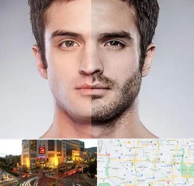 کاشت ریش و سبیل در جنت آباد تهران