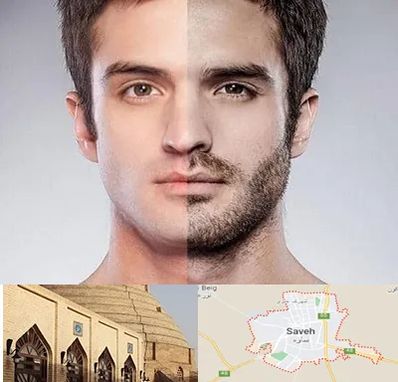 کاشت ریش و سبیل در ساوه