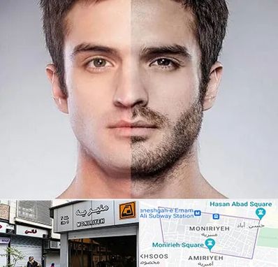 کاشت ریش و سبیل در منیریه